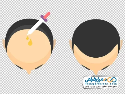 دانلود عکس وکتوری سر برای کاشت مو