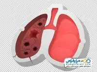تصویر png ریه